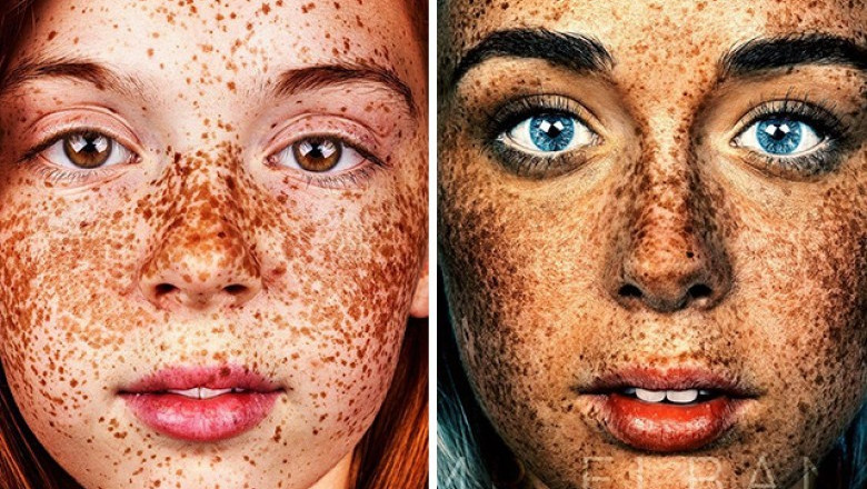 Brock Elbank's Photographs Of The Special Beauty Of Freckled People