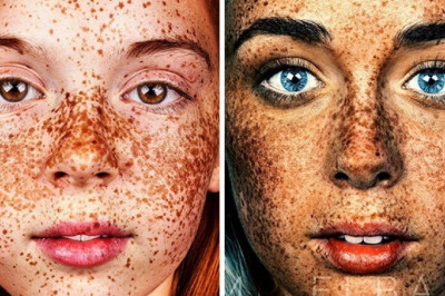 Brock Elbank's Photographs Of The Special Beauty Of Freckled People